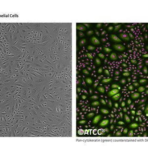 Primary Mammary Epithelial Cells; Normal